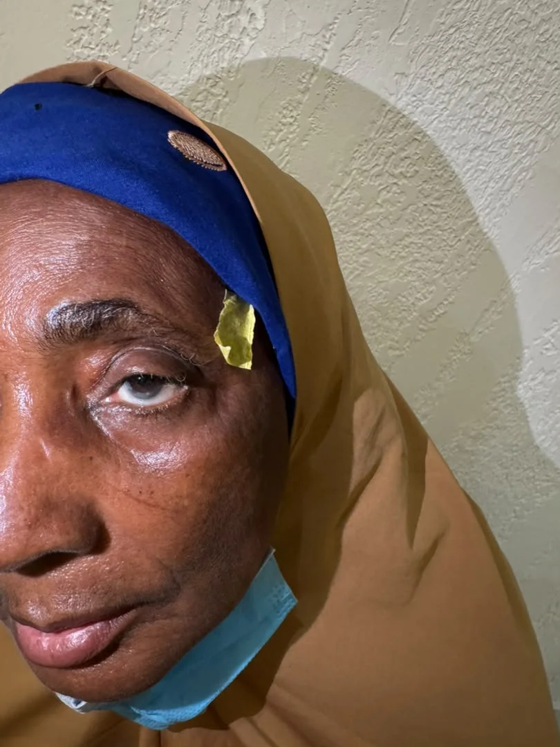 Afrika’da Katarakt Ameliyatı 7